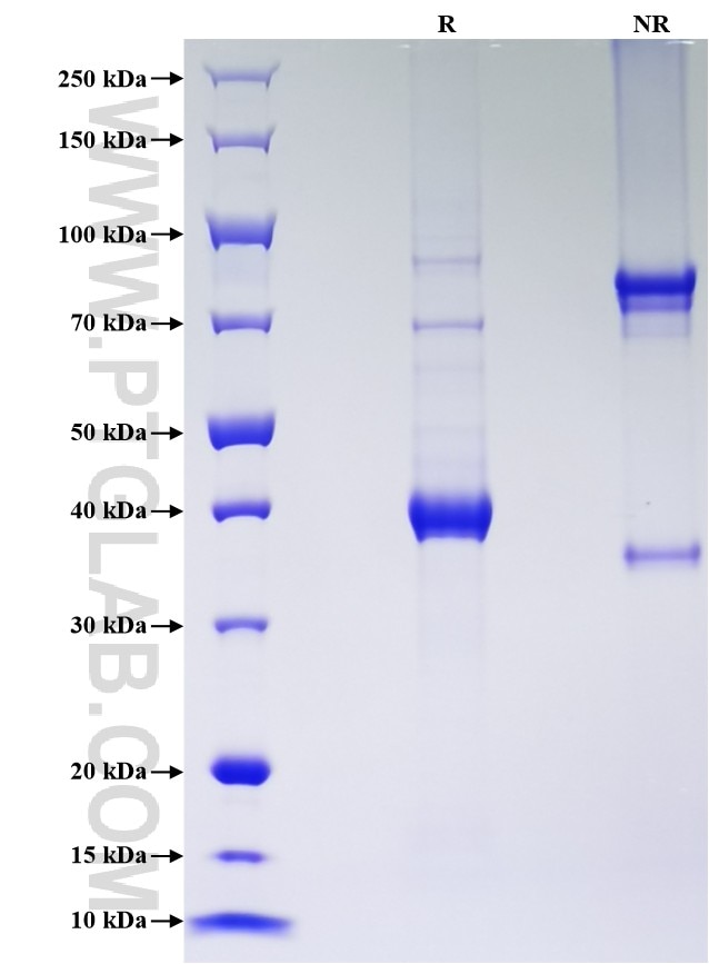 Purity of Recombinant Human MIA was determined by SDS-PAGE. The protein was resolved in an SDS-PAGE in reducing (R) and non-reducing (NR) conditions and stained using Coomassie blue. Purity of Recombinant Human MIA was determined by SDS-PAGE. The protein was resolved in an SDS-PAGE in reducing (R) and non-reducing (NR) conditions and stained using Coomassie blue.
