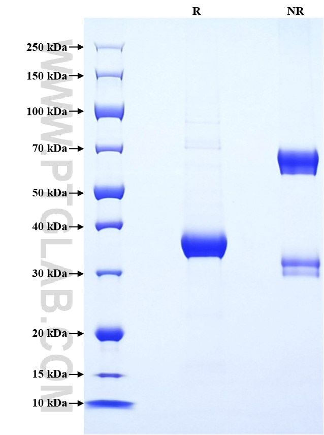 Purity of Recombinant Human CCL15 was determined by SDS-PAGE. The protein was resolved in an SDS-PAGE in reducing (R) and non-reducing (NR) conditions and stained using Coomassie blue.
