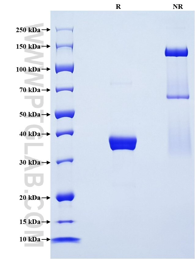 Purity of Recombinant Human CCL14 was determined by SDS-PAGE. The protein was resolved in an SDS-PAGE in reducing (R) and non-reducing (NR) conditions and stained using Coomassie blue.