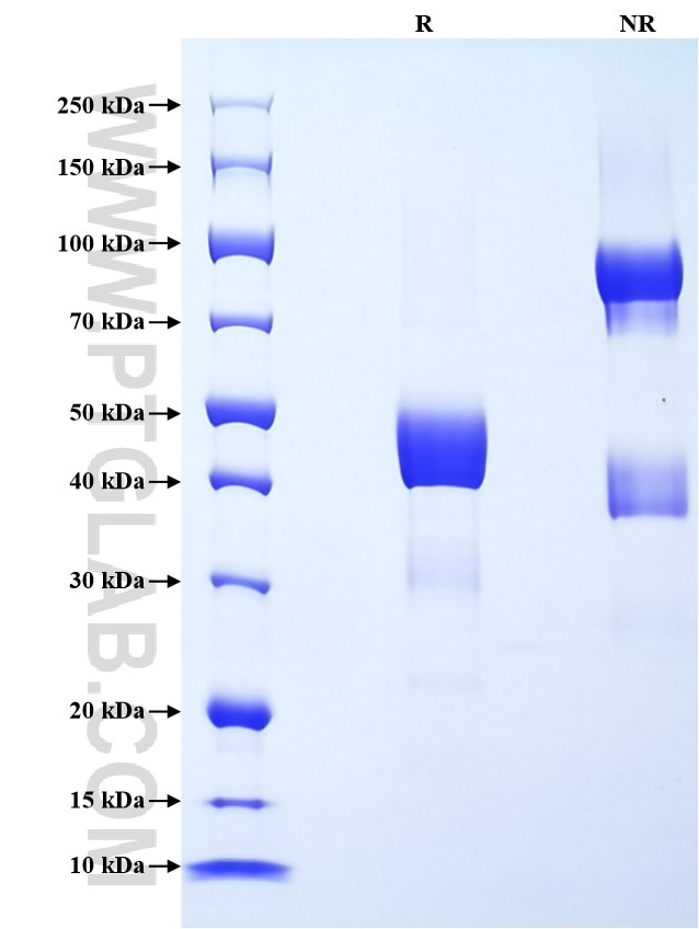 Purity of Recombinant Human PRR4 was determined by SDS-PAGE. The protein was resolved in an SDS-PAGE in reducing (R) and non-reducing (NR) conditions and stained using Coomassie blue. Purity of Recombinant Human PRR4 was determined by SDS-PAGE. The protein was resolved in an SDS-PAGE in reducing (R) and non-reducing (NR) conditions and stained using Coomassie blue.