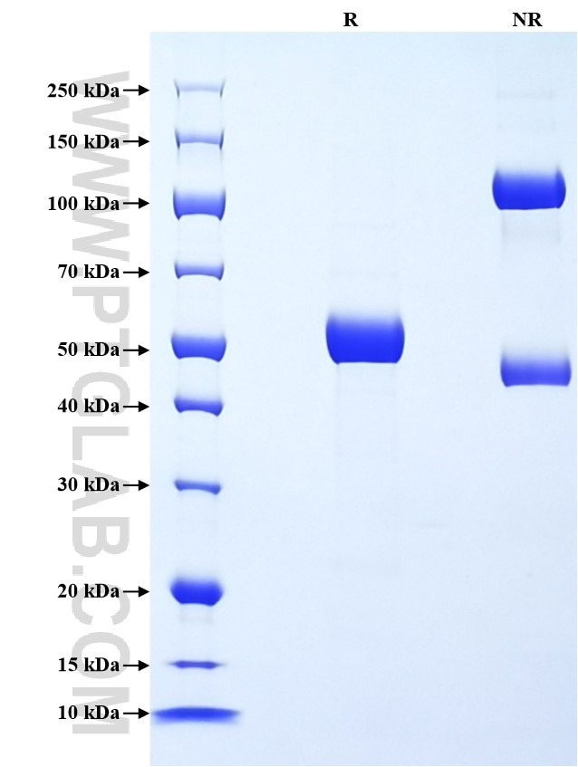 Purity of Recombinant Human Ephrin B3 was determined by SDS-PAGE. The protein was resolved in an SDS-PAGE in reducing (R) and non-reducing (NR) conditions and stained using Coomassie blue. Purity of Recombinant Human Ephrin B3 was determined by SDS-PAGE. The protein was resolved in an SDS-PAGE in reducing (R) and non-reducing (NR) conditions and stained using Coomassie blue.