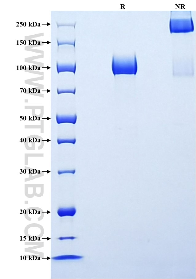 Purity of Recombinant Human GPNMB was determined by SDS-PAGE. The protein was resolved in an SDS-PAGE in reducing (R) and non-reducing (NR) conditions and stained using Coomassie blue. Purity of Recombinant Human GPNMB was determined by SDS-PAGE. The protein was resolved in an SDS-PAGE in reducing (R) and non-reducing (NR) conditions and stained using Coomassie blue.