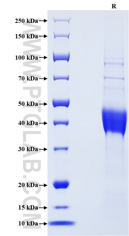 Purity of Recombinant Human Mammaglobin A was determined by SDS-PAGE. The protein was resolved in an SDS-PAGE in reducing (R) conditions and stained using Coomassie blue.