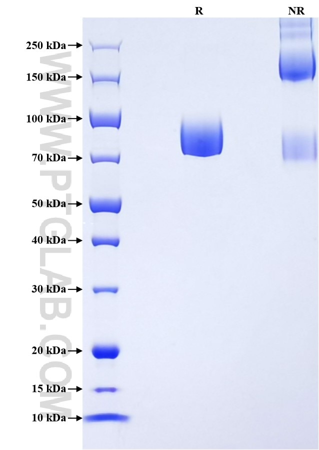 Purity of Recombinant Human TYRO3 was determined by SDS-PAGE. The protein was resolved in an SDS-PAGE in reducing (R) and non-reducing (NR) conditions and stained using Coomassie blue. Purity of Recombinant Human TYRO3 was determined by SDS-PAGE. The protein was resolved in an SDS-PAGE in reducing (R) and non-reducing (NR) conditions and stained using Coomassie blue.