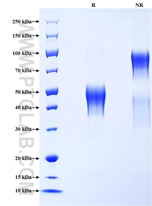 Purity of Recombinant Mouse Betacellulin was determined by SDS-PAGE. The protein was resolved in an SDS-PAGE in reducing (R) and non-reducing (NR) conditions and stained using Coomassie blue. Purity of Recombinant Mouse Betacellulin was determined by SDS-PAGE. The protein was resolved in an SDS-PAGE in reducing (R) and non-reducing (NR) conditions and stained using Coomassie blue.