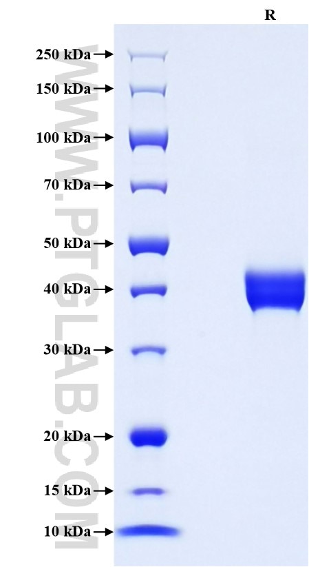 Purity of Recombinant Human TFF2 was determined by SDS-PAGE. The protein was resolved in an SDS-PAGE in reducing (R) conditions and stained using Coomassie blue.