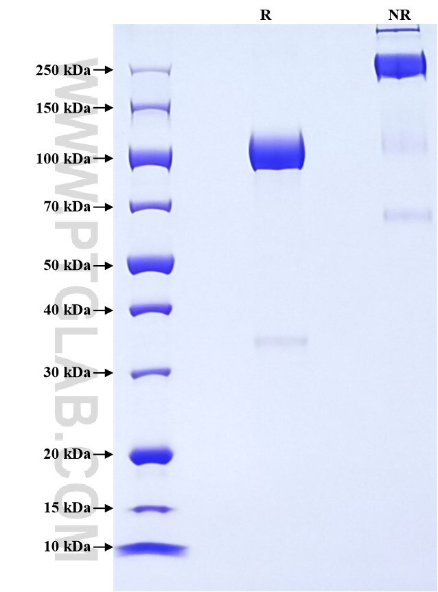 Purity of Recombinant Mouse Butyrylcholinesterase was determined by SDS-PAGE. The protein was resolved in an SDS-PAGE in reducing (R) and non-reducing (NR) conditions and stained using Coomassie blue.