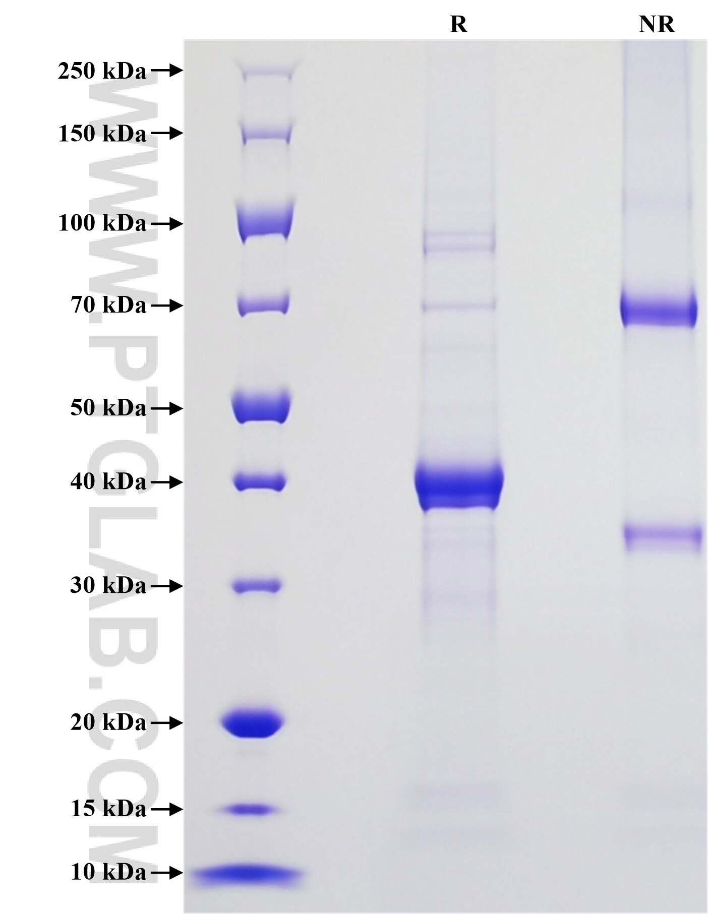Purity of Recombinant Mouse SLPI was determined by SDS-PAGE. The protein was resolved in an SDS-PAGE in reducing (R) and non-reducing (NR) conditions and stained using Coomassie blue.