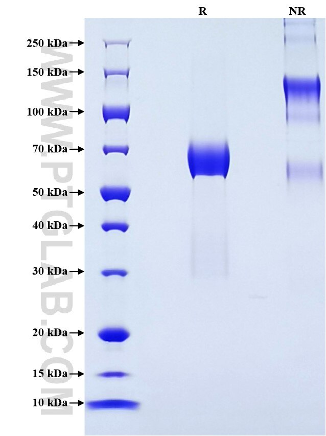 Purity of Recombinant Human DLK1 was determined by SDS-PAGE. The protein was resolved in an SDS-PAGE in reducing (R) and non-reducing (NR) conditions and stained using Coomassie blue.