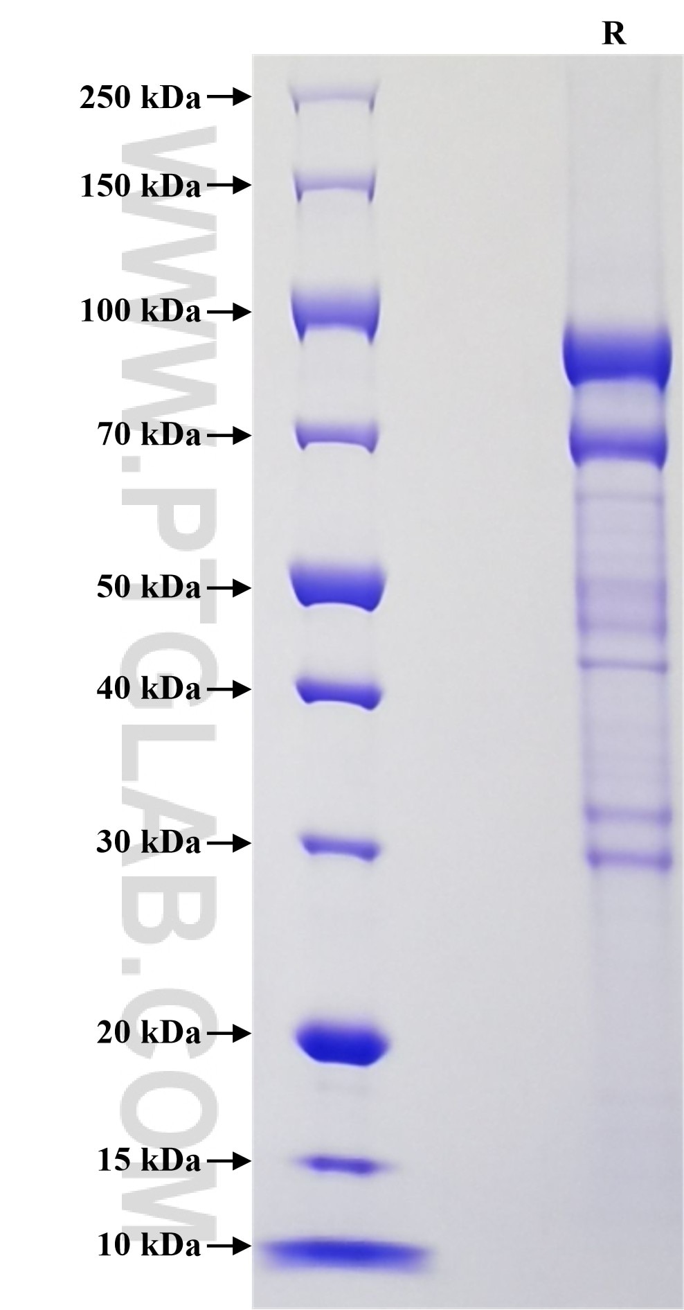 Purity of Recombinant Human ADAM8 was determined by SDS-PAGE. The protein was resolved in an SDS-PAGE in reducing (R) conditions and stained using Coomassie blue.
