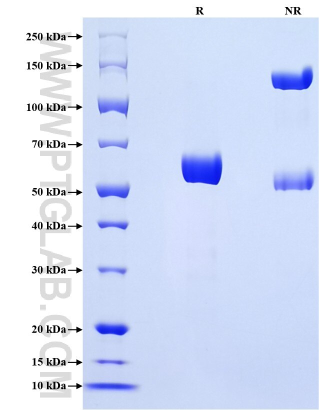 Purity of Recombinant Human JAM2 was determined by SDS-PAGE. The protein was resolved in an SDS-PAGE in reducing (R) and non-reducing (NR) conditions and stained using Coomassie blue.
