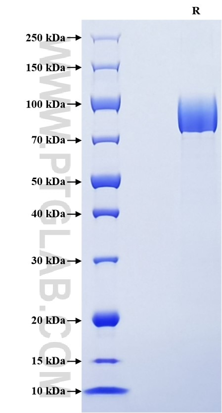 Purity of Recombinant Mouse TYRO3 was determined by SDS-PAGE. The protein was resolved in an SDS-PAGE in reducing (R) conditions and stained using Coomassie blue. Purity of Recombinant Mouse TYRO3 was determined by SDS-PAGE. The protein was resolved in an SDS-PAGE in reducing (R) conditions and stained using Coomassie blue.