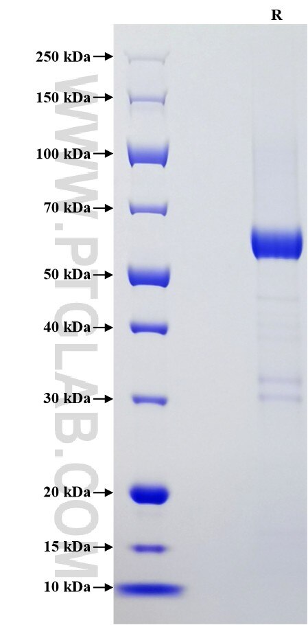 Purity of Recombinant Human GAS1 was determined by SDS-PAGE. The protein was resolved in an SDS-PAGE in reducing (R) conditions and stained using Coomassie blue.