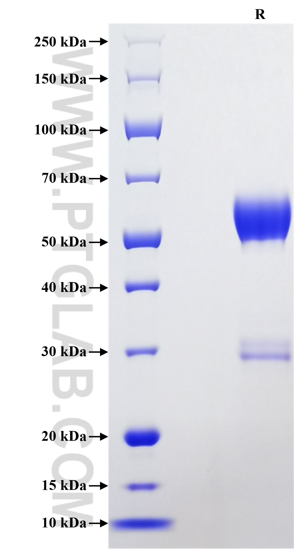 Purity of Recombinant Mouse Oncostatin M was determined by SDS-PAGE. The protein was resolved in an SDS-PAGE in reducing (R) conditions and stained using Coomassie blue. Purity of Recombinant Mouse Oncostatin M was determined by SDS-PAGE. The protein was resolved in an SDS-PAGE in reducing (R) conditions and stained using Coomassie blue.
