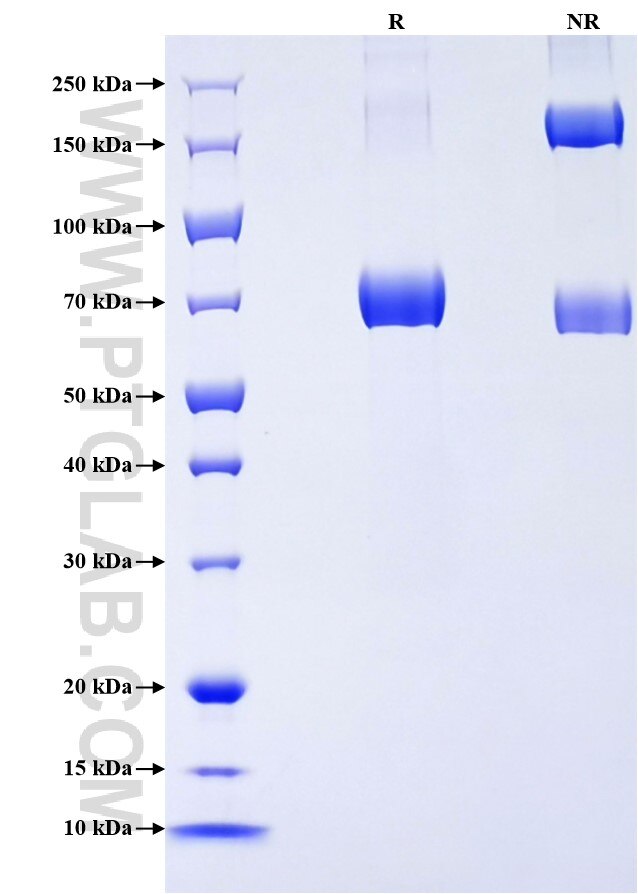 Purity of Recombinant Human Lumican was determined by SDS-PAGE. The protein was resolved in an SDS-PAGE in reducing (R) and non-reducing (NR) conditions and stained using Coomassie blue.