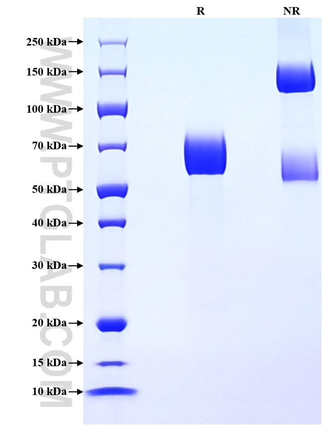 Purity of Recombinant Human IFNAR2 was determined by SDS-PAGE. The protein was resolved in an SDS-PAGE in reducing (R) and non-reducing (NR) conditions and stained using Coomassie blue.