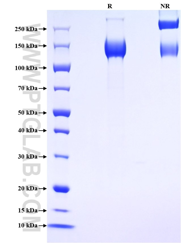 Purity of Recombinant Mouse Lepr was determined by SDS-PAGE. The protein was resolved in an SDS-PAGE in reducing (R) and non-reducing (NR) conditions and stained using Coomassie blue. Purity of Recombinant Mouse Lepr was determined by SDS-PAGE. The protein was resolved in an SDS-PAGE in reducing (R) and non-reducing (NR) conditions and stained using Coomassie blue.