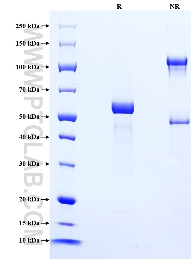 Purity of Recombinant Mouse IGFBP1 was determined by SDS-PAGE. The protein was resolved in an SDS-PAGE in reducing (R) and non-reducing (NR) conditions and stained using Coomassie blue. Purity of Recombinant Mouse IGFBP1 was determined by SDS-PAGE. The protein was resolved in an SDS-PAGE in reducing (R) and non-reducing (NR) conditions and stained using Coomassie blue.