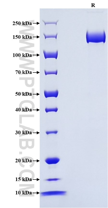 Purity of Recombinant Human DCC was determined by SDS-PAGE. The protein was resolved in an SDS-PAGE in reducing (R) conditions and stained using Coomassie blue.
