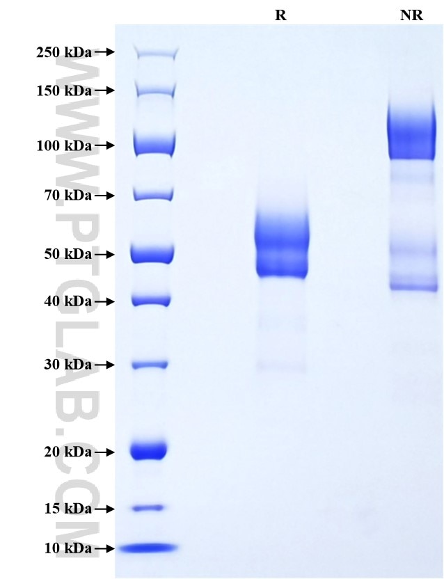 Purity of Recombinant Human SDC2 was determined by SDS-PAGE. The protein was resolved in an SDS-PAGE in reducing (R) and non-reducing (NR) conditions and stained using Coomassie blue. Purity of Recombinant Human SDC2 was determined by SDS-PAGE. The protein was resolved in an SDS-PAGE in reducing (R) and non-reducing (NR) conditions and stained using Coomassie blue.