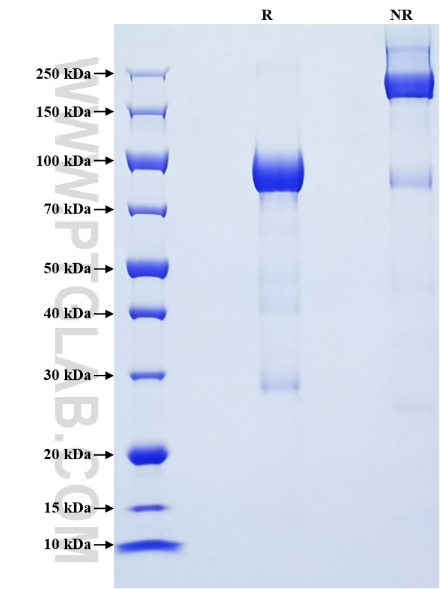 Purity of Recombinant Human DSG3 was determined by SDS-PAGE. The protein was resolved in an SDS-PAGE in reducing (R) and non-reducing (NR) conditions and stained using Coomassie blue.