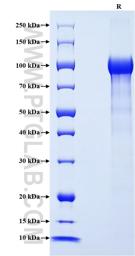 Purity of Recombinant Human Progranulin was determined by SDS-PAGE. The protein was resolved in an SDS-PAGE in reducing (R) conditions and stained using Coomassie blue.