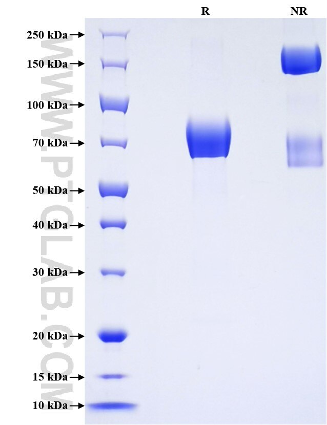 Purity of Recombinant Mouse IL-1R2 was determined by SDS-PAGE. The protein was resolved in an SDS-PAGE in reducing (R) and non-reducing (NR) conditions and stained using Coomassie blue.