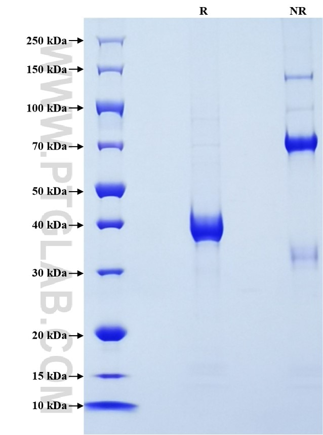 Purity of Recombinant Mouse Ccl6 was determined by SDS-PAGE. The protein was resolved in an SDS-PAGE in reducing (R) and non-reducing (NR) conditions and stained using Coomassie blue. Purity of Recombinant Mouse Ccl6 was determined by SDS-PAGE. The protein was resolved in an SDS-PAGE in reducing (R) and non-reducing (NR) conditions and stained using Coomassie blue.