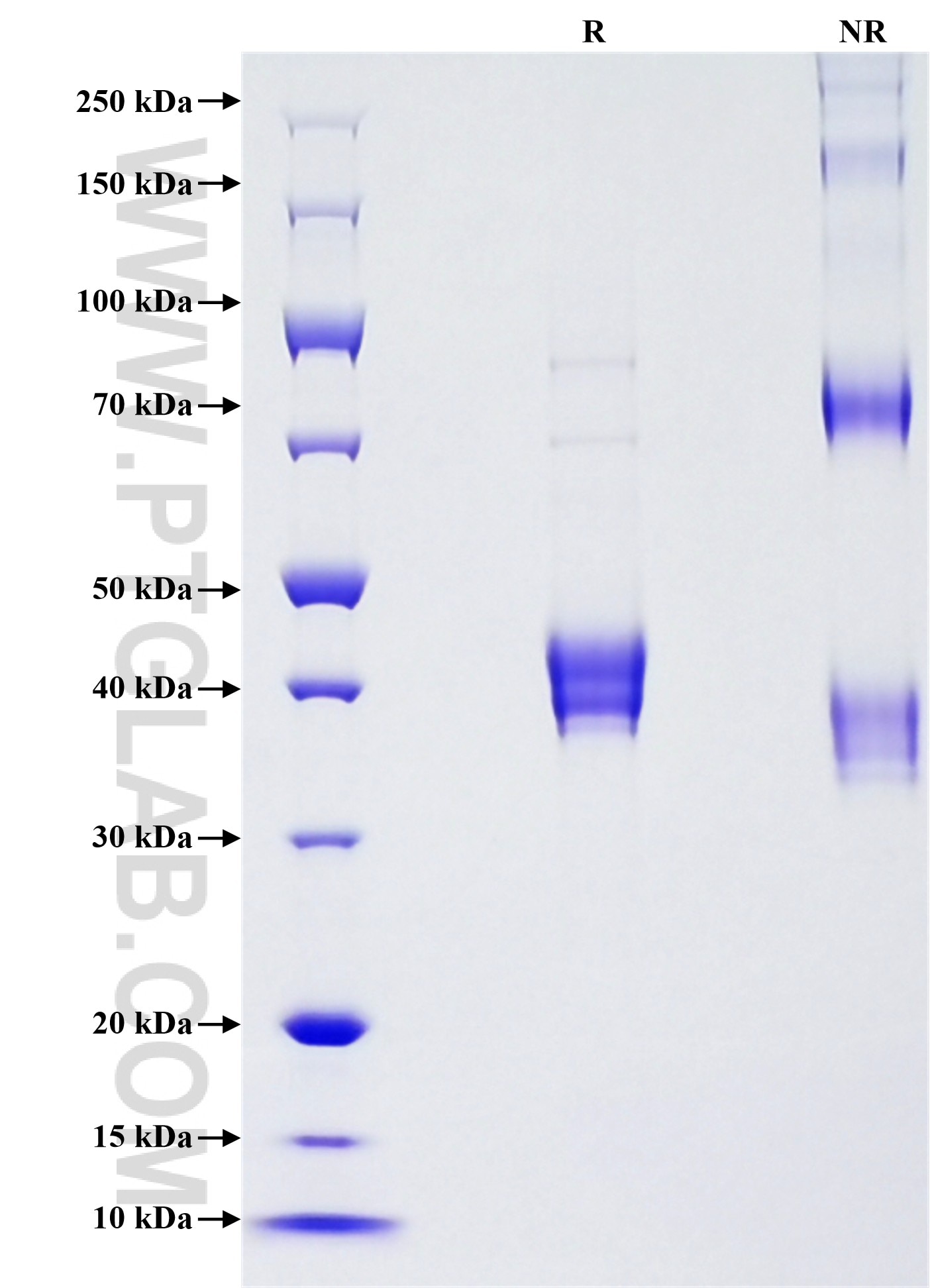 Purity of Recombinant Mouse S100A8 was determined by SDS-PAGE. The protein was resolved in an SDS-PAGE in reducing (R) and non-reducing (NR) conditions and stained using Coomassie blue. Purity of Recombinant Mouse S100A8 was determined by SDS-PAGE. The protein was resolved in an SDS-PAGE in reducing (R) and non-reducing (NR) conditions and stained using Coomassie blue.