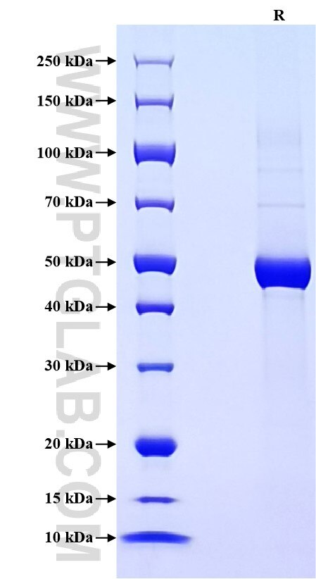 Purity of Recombinant Mouse TIMP2 was determined by SDS-PAGE. The protein was resolved in an SDS-PAGE in reducing (R) conditions and stained using Coomassie blue.
