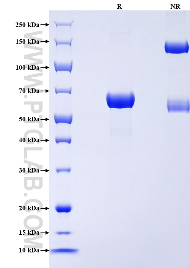Purity of Recombinant Human Carbonic Anhydrase 6 was determined by SDS-PAGE. The protein was resolved in an SDS-PAGE in reducing (R) and non-reducing (NR) conditions and stained using Coomassie blue.