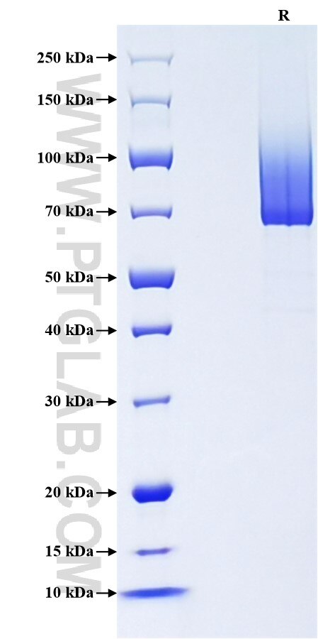Purity of Recombinant Human Biglycan was determined by SDS-PAGE. The protein was resolved in an SDS-PAGE in reducing (R) conditions and stained using Coomassie blue. Purity of Recombinant Human Biglycan was determined by SDS-PAGE. The protein was resolved in an SDS-PAGE in reducing (R) conditions and stained using Coomassie blue.