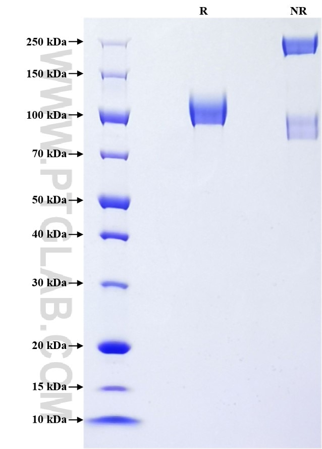 Purity of Recombinant Human MAG was determined by SDS-PAGE. The protein was resolved in an SDS-PAGE in reducing (R) and non-reducing (NR) conditions and stained using Coomassie blue.
