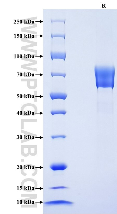 Purity of Recombinant Human C4BPB was determined by SDS-PAGE. The protein was resolved in an SDS-PAGE in reducing (R) conditions and stained using Coomassie blue.
