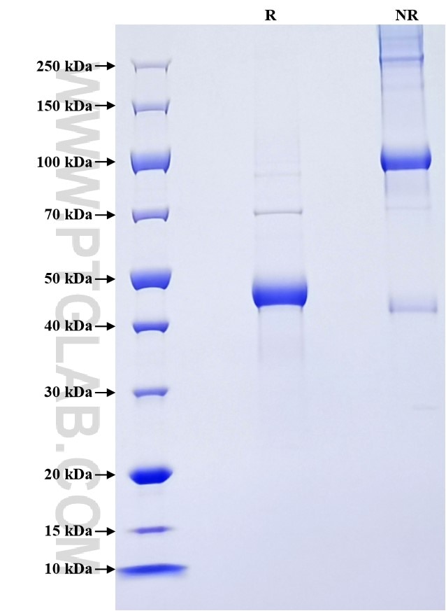 Purity of Recombinant Human PMCH was determined by SDS-PAGE. The protein was resolved in an SDS-PAGE in reducing (R) and non-reducing (NR) conditions and stained using Coomassie blue.