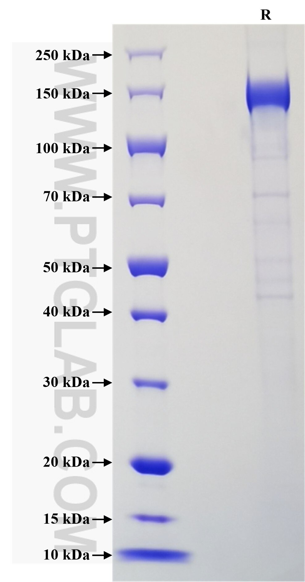 Purity of Recombinant Human CD21 was determined by SDS-PAGE. The protein was resolved in an SDS-PAGE in reducing (R) conditions and stained using Coomassie blue. Purity of Recombinant Human CD21 was determined by SDS-PAGE. The protein was resolved in an SDS-PAGE in reducing (R) conditions and stained using Coomassie blue.