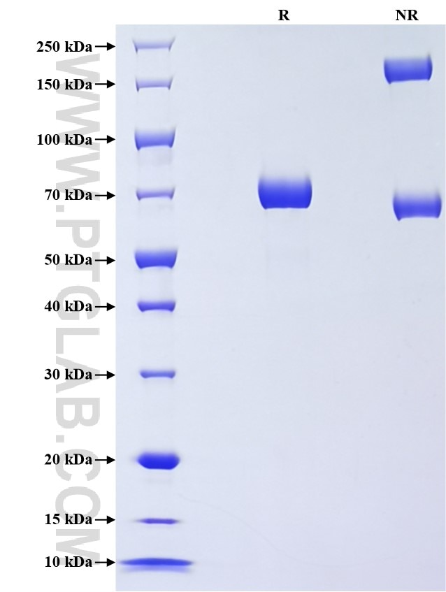 Purity of Recombinant Mouse Cathepsin D was determined by SDS-PAGE. The protein was resolved in an SDS-PAGE in reducing (R) and non-reducing (NR) conditions and stained using Coomassie blue.