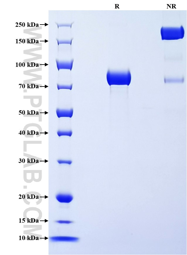 Purity of Recombinant Human NPRC was determined by SDS-PAGE. The protein was resolved in an SDS-PAGE in reducing (R) and non-reducing (NR) conditions and stained using Coomassie blue.