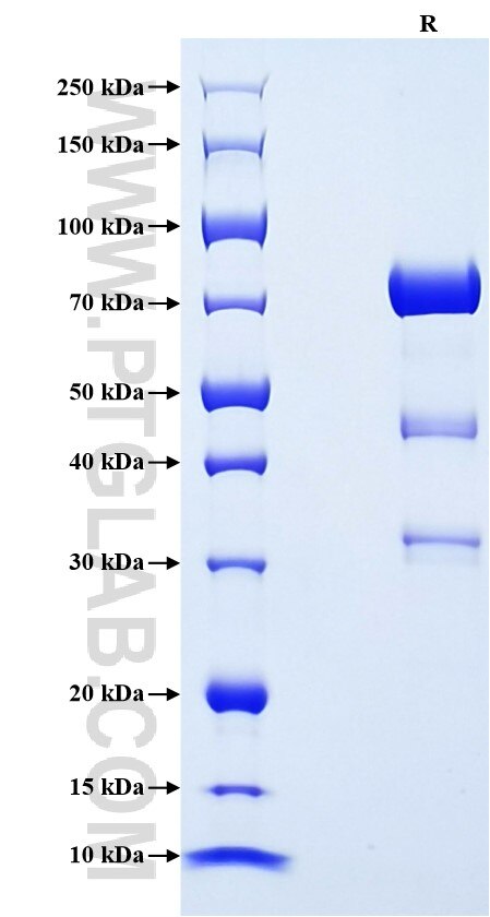 Purity of Recombinant Human CPE was determined by SDS-PAGE. The protein was resolved in an SDS-PAGE in reducing (R) condition and stained using Coomassie blue.