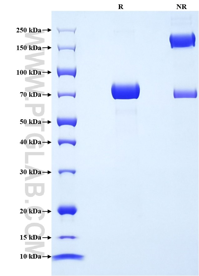 Purity of Recombinant Human PNLIP was determined by SDS-PAGE. The protein was resolved in an SDS-PAGE in reducing (R) and non-reducing (NR) conditions and stained using Coomassie blue.