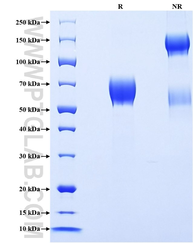 Purity of Recombinant Human IFNGR1 was determined by SDS-PAGE. The protein was resolved in an SDS-PAGE in reducing (R) and non-reducing (NR) conditions and stained using Coomassie blue.