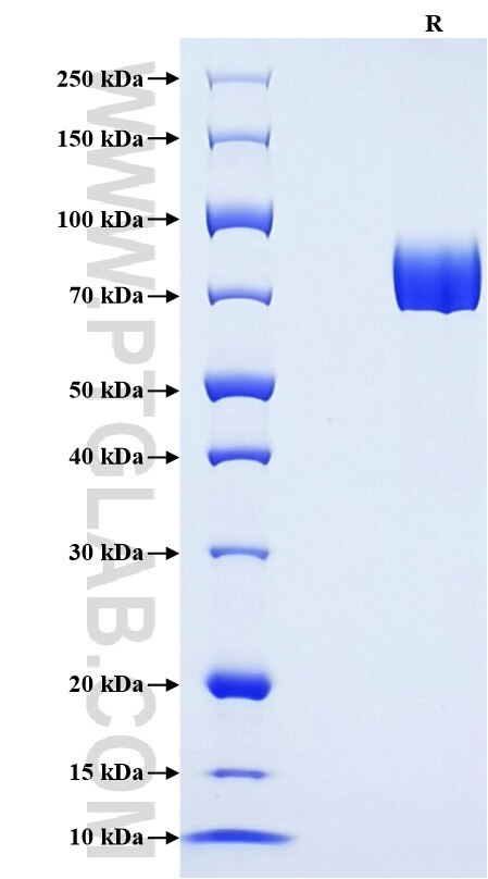 Purity of Recombinant Human IL-1R1 was determined by SDS-PAGE. The protein was resolved in an SDS-PAGE in reducing (R) conditions and stained using Coomassie blue.
