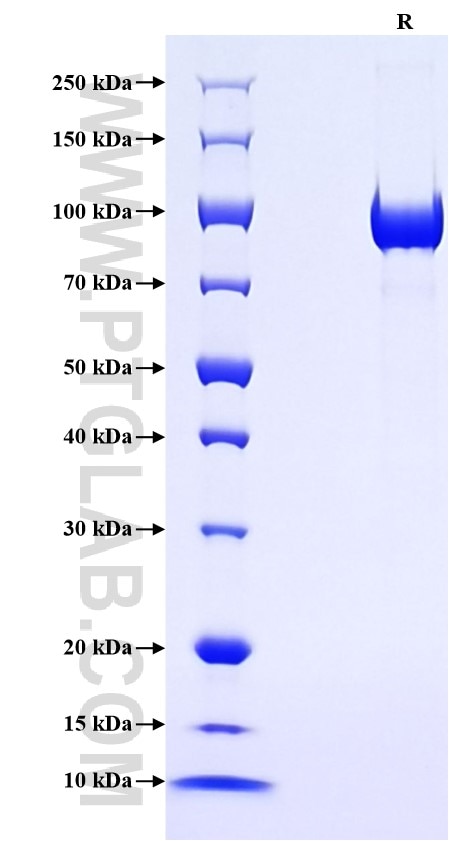 Purity of Recombinant Human PDIA4 was determined by SDS-PAGE. The protein was resolved in an SDS-PAGE in reducing (R) conditions and stained using Coomassie blue. Purity of Recombinant Human PDIA4 was determined by SDS-PAGE. The protein was resolved in an SDS-PAGE in reducing (R) conditions and stained using Coomassie blue.
