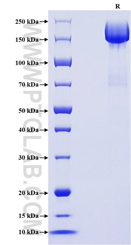 Purity of Recombinant Mouse L1cam was determined by SDS-PAGE. The protein was resolved in an SDS-PAGE in reducing (R) conditions and stained using Coomassie blue.