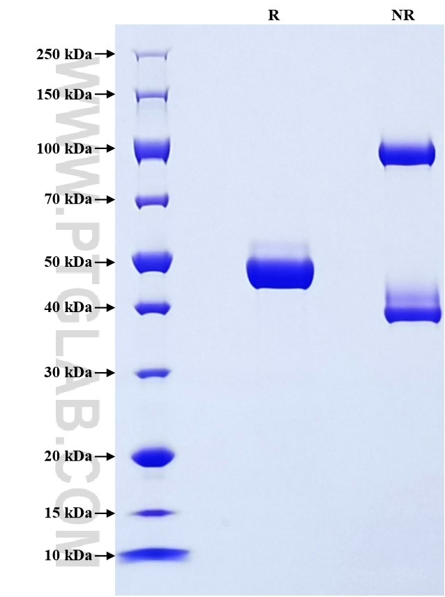 Purity of Recombinant Mouse Mup1 was determined by SDS-PAGE. The protein was resolved in an SDS-PAGE in reducing (R) and non-reducing (NR) conditions and stained using Coomassie blue. Purity of Recombinant Mouse Mup1 was determined by SDS-PAGE. The protein was resolved in an SDS-PAGE in reducing (R) and non-reducing (NR) conditions and stained using Coomassie blue.