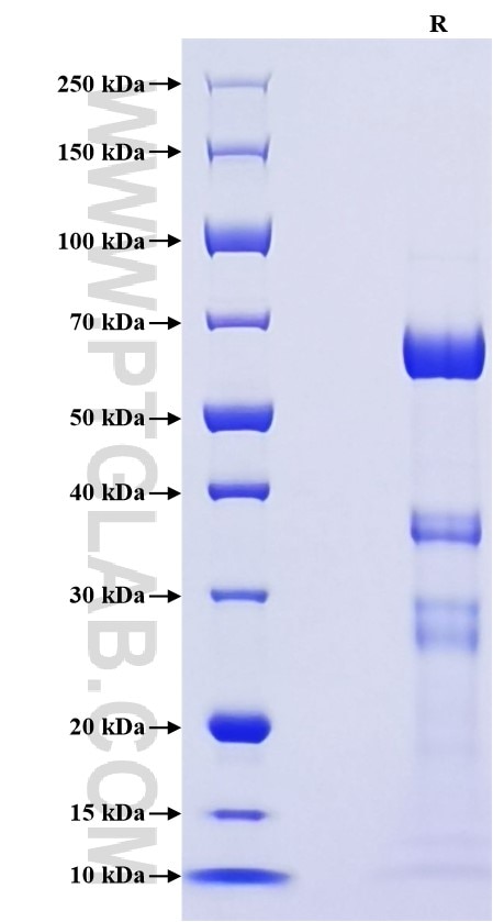 Purity of Recombinant Mouse tPA was determined by SDS-PAGE. The protein was resolved in an SDS-PAGE in reducing (R) conditions and stained using Coomassie blue.