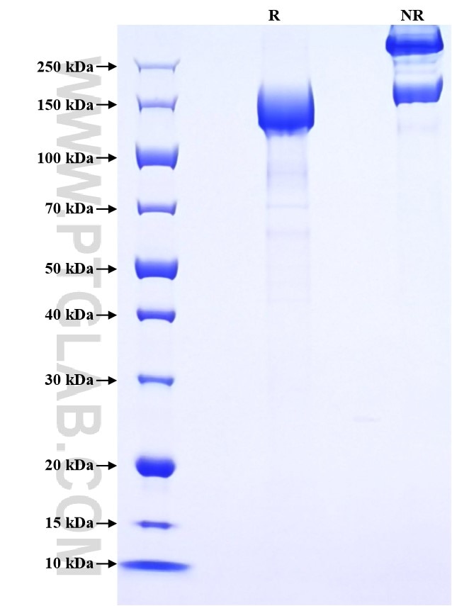Purity of Recombinant Mouse NID1 was determined by SDS-PAGE. The protein was resolved in an SDS-PAGE in reducing (R) and non-reducing (NR) conditions and stained using Coomassie blue. Purity of Recombinant Mouse NID1 was determined by SDS-PAGE. The protein was resolved in an SDS-PAGE in reducing (R) and non-reducing (NR) conditions and stained using Coomassie blue.