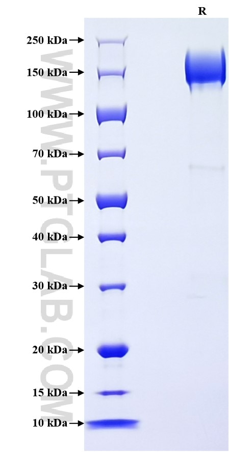Purity of Recombinant Mouse ACE was determined by SDS-PAGE. The protein was resolved in an SDS-PAGE in reducing (R) conditions and stained using Coomassie blue. Purity of Recombinant Mouse ACE was determined by SDS-PAGE. The protein was resolved in an SDS-PAGE in reducing (R) conditions and stained using Coomassie blue.