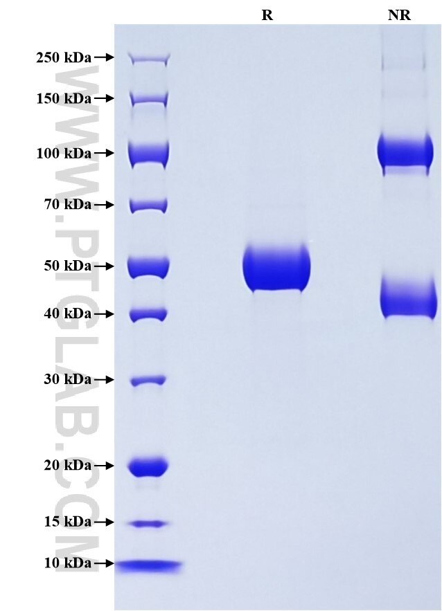 Purity of Recombinant Human PAEP was determined by SDS-PAGE. The protein was resolved in an SDS-PAGE in reducing (R) and non-reducing (NR) conditions and stained using Coomassie blue.