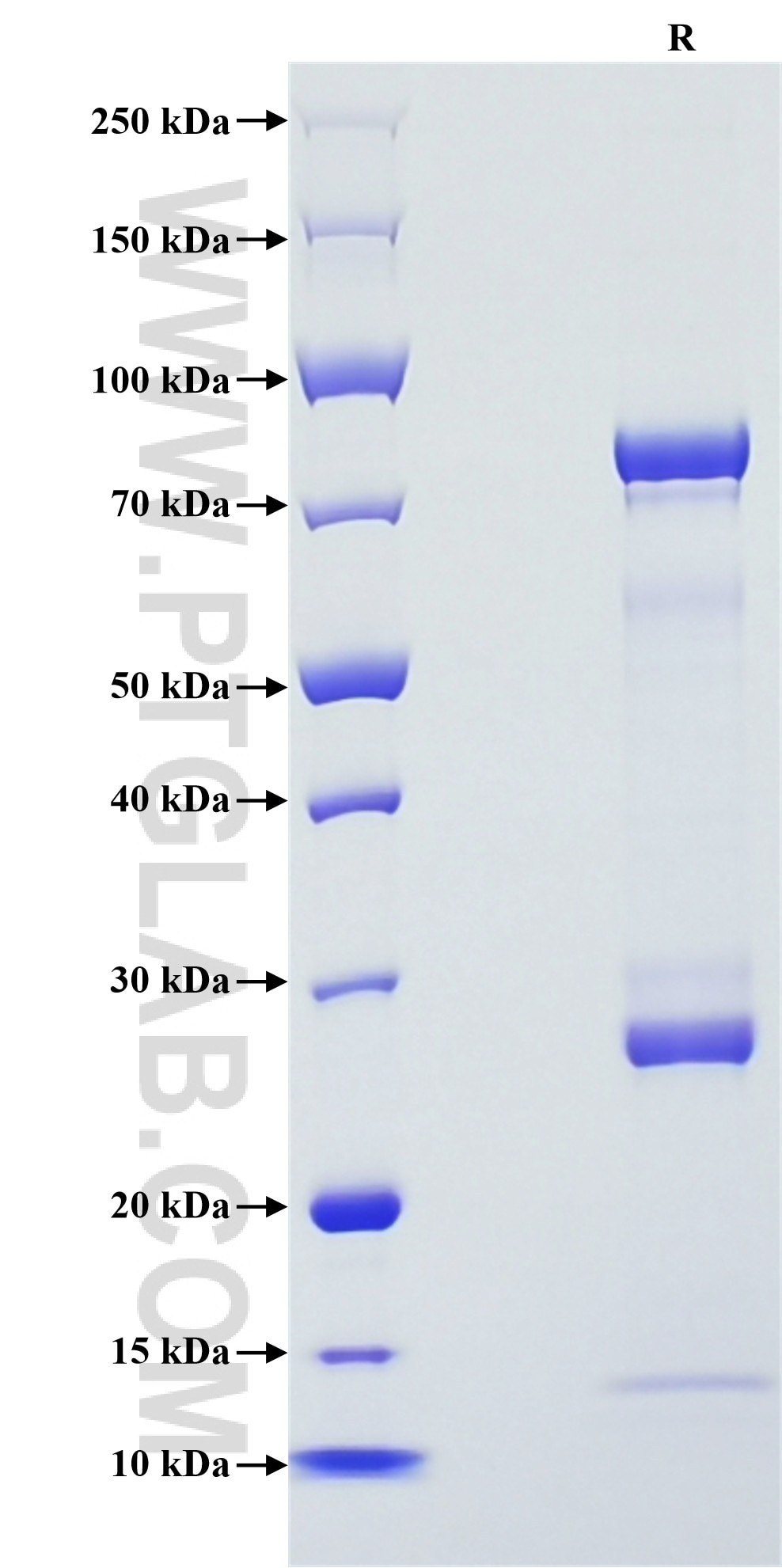 Purity of Recombinant Human MMP10 was determined by SDS-PAGE. The protein was resolved in an SDS-PAGE in reducing (R) conditions and stained using Coomassie blue. Purity of Recombinant Human MMP10 was determined by SDS-PAGE. The protein was resolved in an SDS-PAGE in reducing (R) conditions and stained using Coomassie blue.